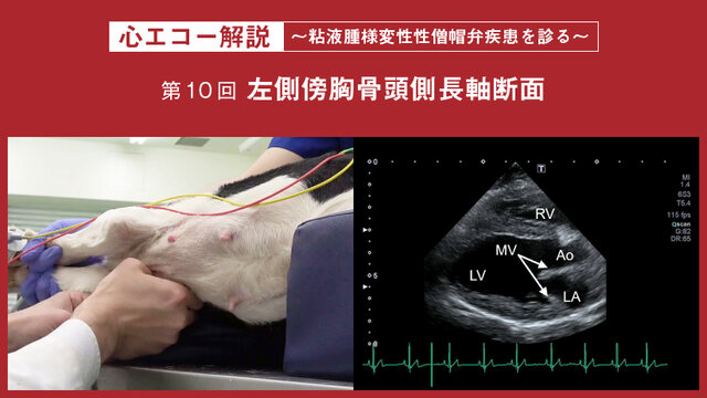 心エコー解説 ～粘液腫様変性性僧帽弁疾患を診る～【第10回】左側傍胸
