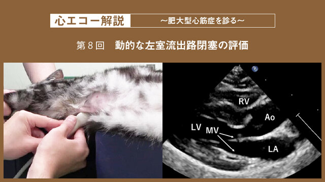 心エコー解説 ～肥大型心筋症を診る～【第8回】動的な左室流出路閉塞の
