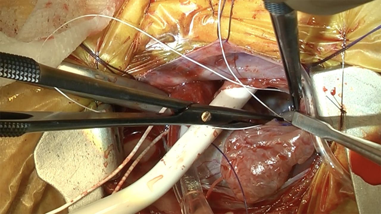 写真3：1.6kgの小型犬に対して実施された体外循環下...