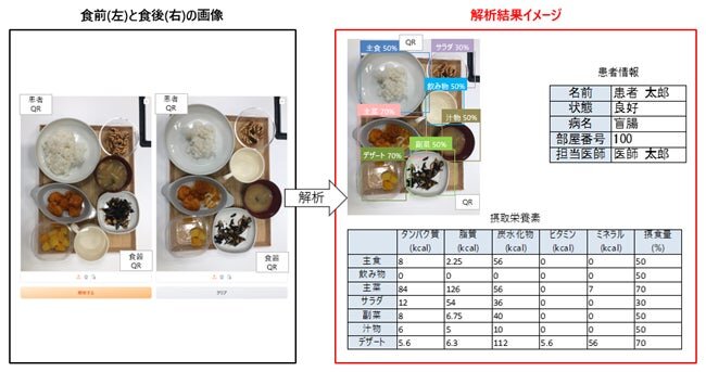 セカンドサイトアナリティカ、エクシオグループ、大和電設工業が共同で、医療・介護現場向け「摂食量自動判定AI」の特許を取得