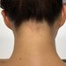 バックシェービング