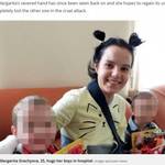 【ロシア発】浮気を疑われ、夫に斧で両腕を切断された女性|回復後まさかの行動に…!