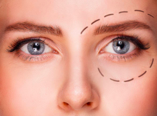 カラコンのちょっと怖い話 度数が合わないコンタクトレンズを使い続けるとどうなる