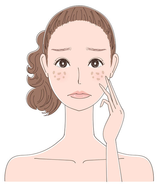 くすみの原因と対策法 血行不良