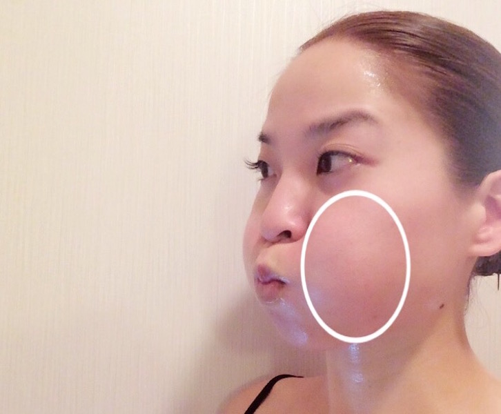 アンチエイジング たるみ 空気を入れて5秒間キープ