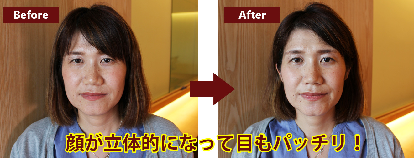 かっさafter