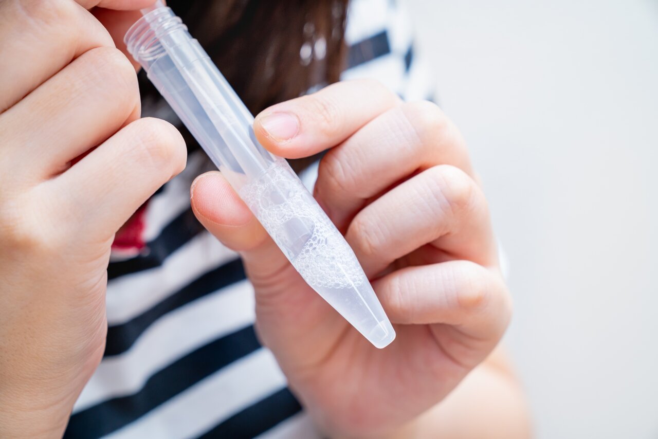 唾液でわかるあなたの口内環境　唾液検査の方法と口内環境改善のポイント