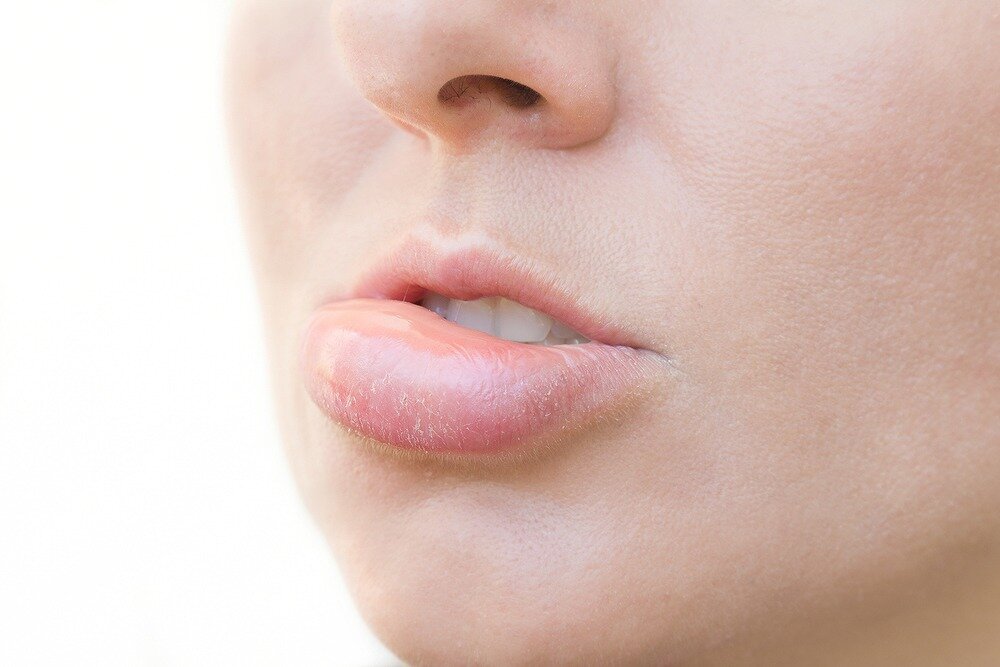 唇が腫れた原因は？考えられる病気と受診の目安を解説【歯科医師監修】