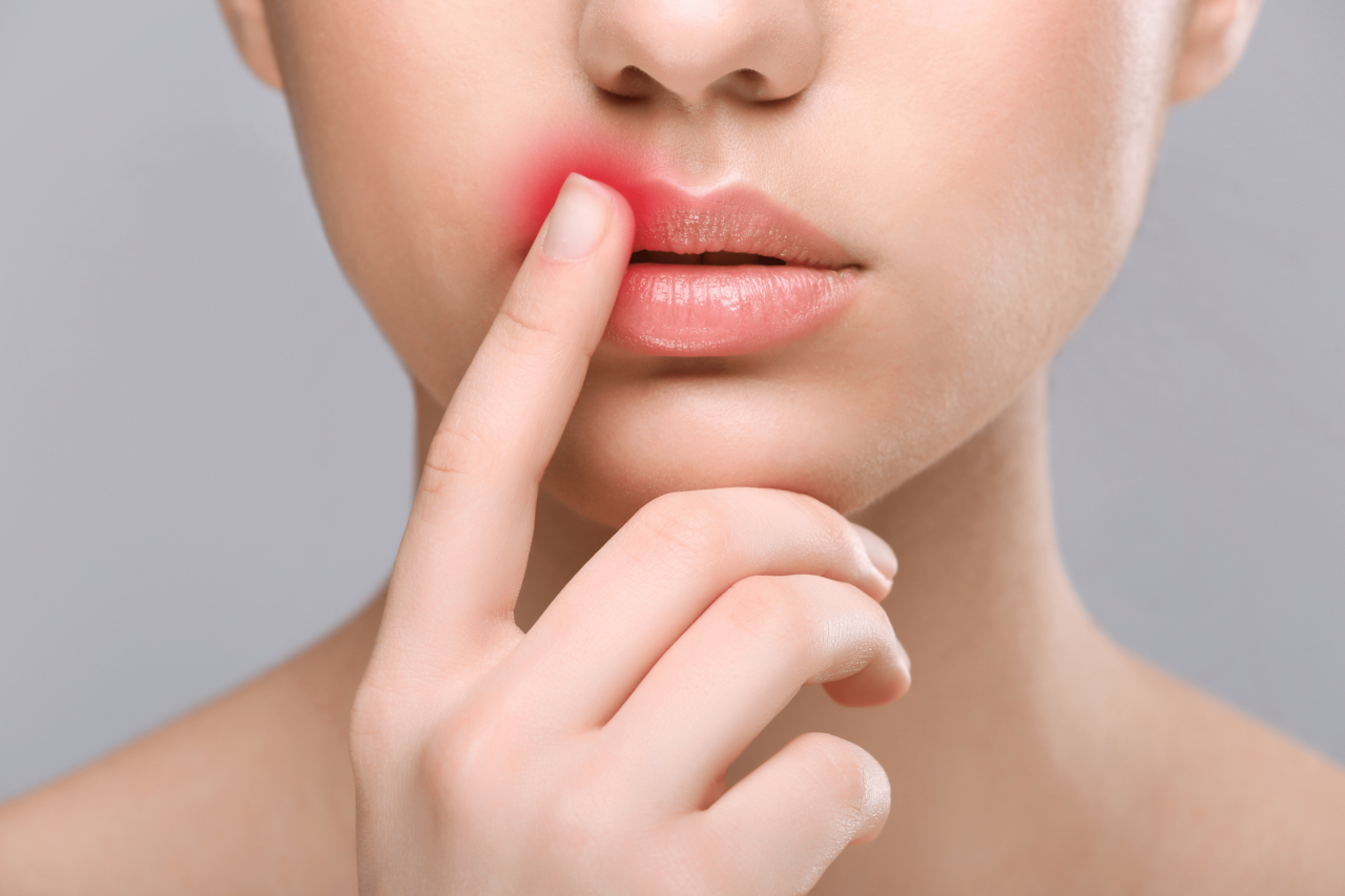 急に唇が腫れる原因は? 症状が表れたときの対処法について解説【医師監修】