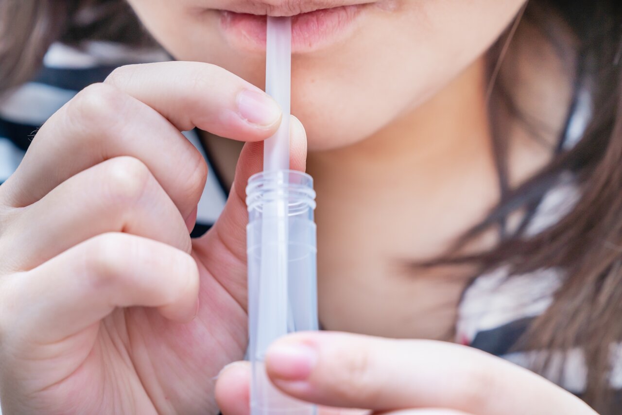 歯科の唾液検査でわかることは？ 口のタイプを調べてオーラルケアを最適化