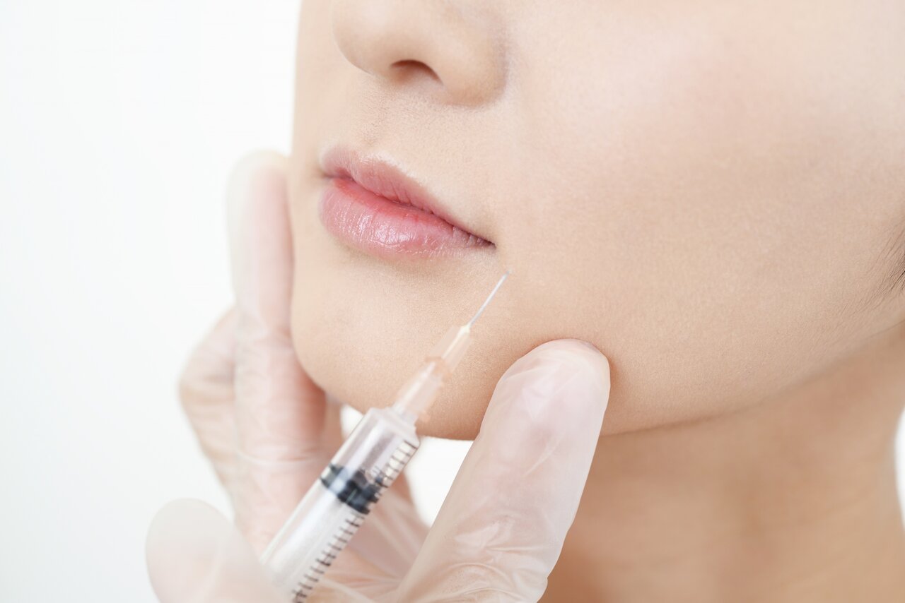 ボトックスは歯ぎしり改善に効果がある？治療の内容や注意することについて解説