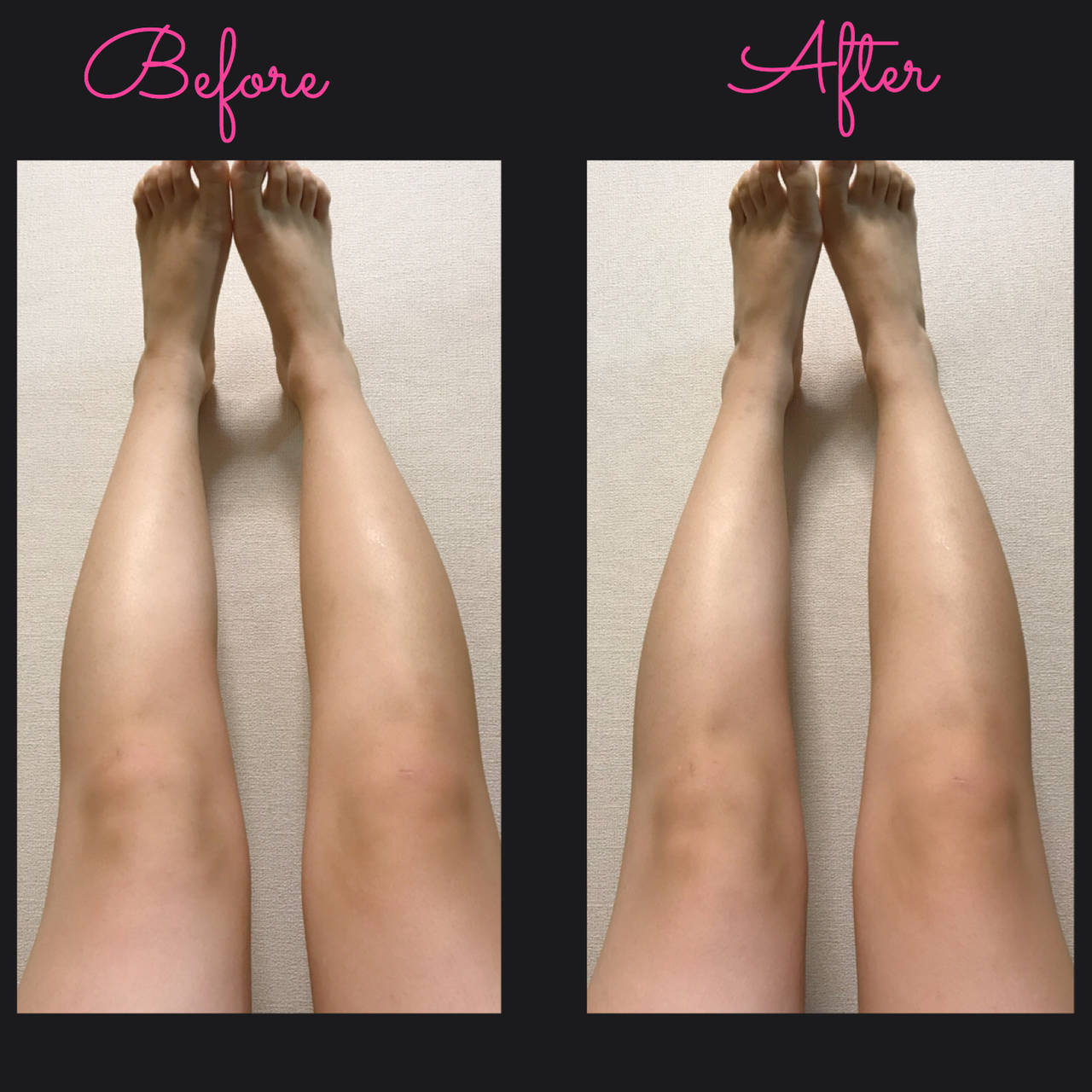 アセチノ リファとアセチノの効果を検証してみました Girlsエディター発 With Online 講談社公式 恋も仕事もわたしらしく