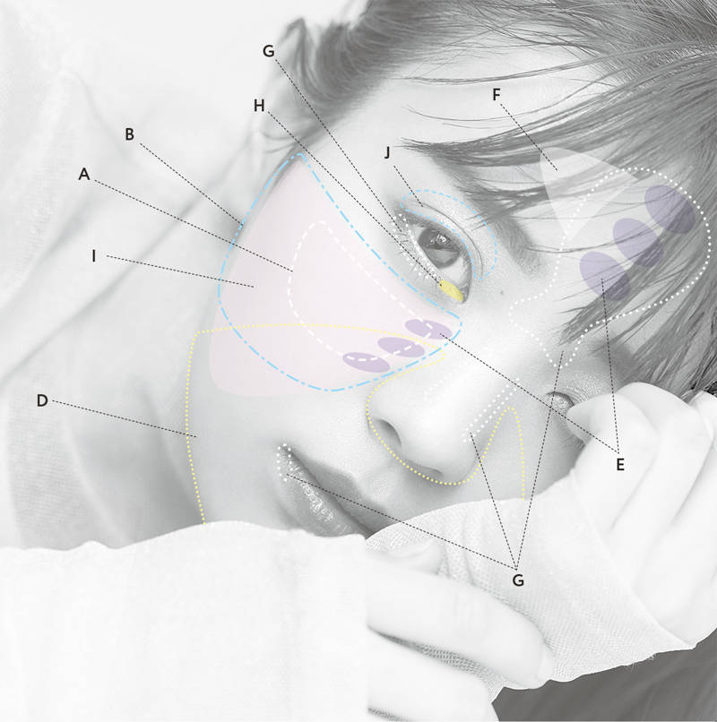 pattern_1