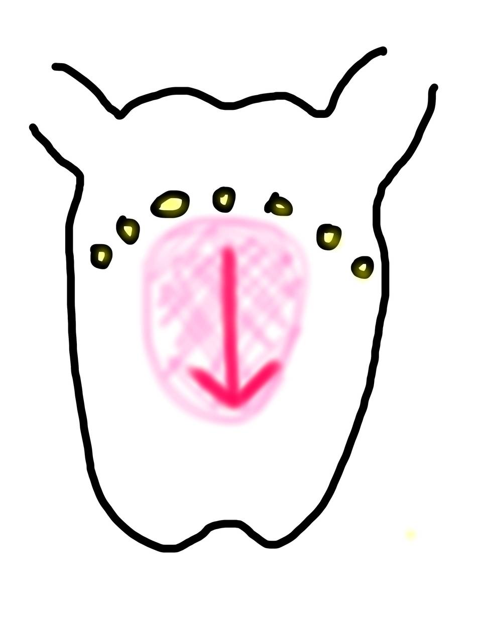 pattern_1