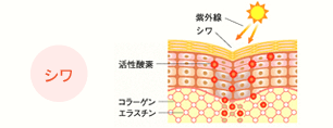 pattern_1