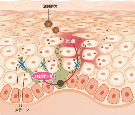 pattern_1