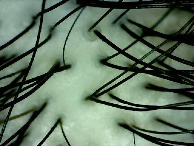 pattern_1