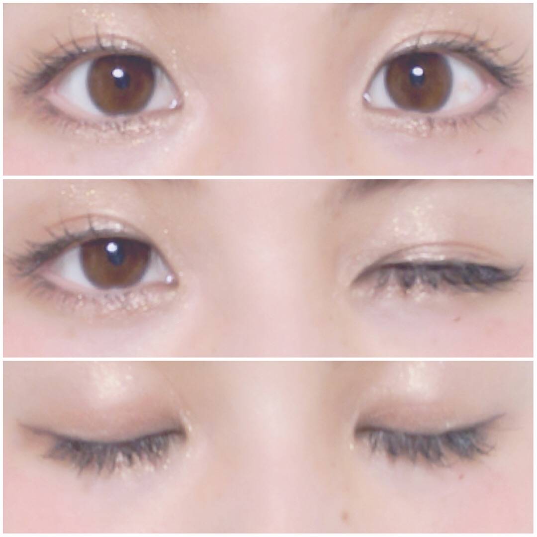 pattern_1
