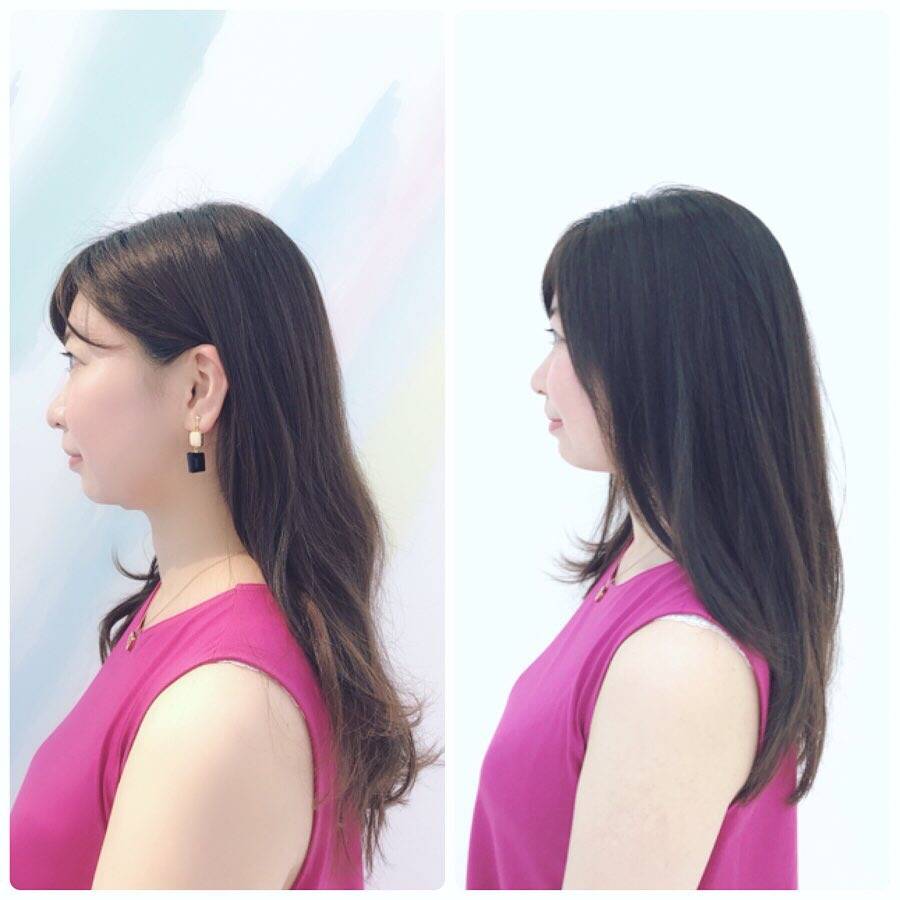 pattern_1