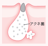pattern_1