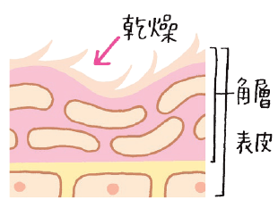 pattern_1