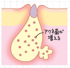pattern_1
