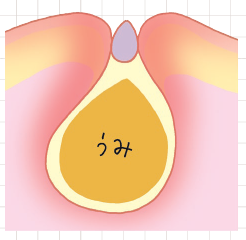 pattern_1