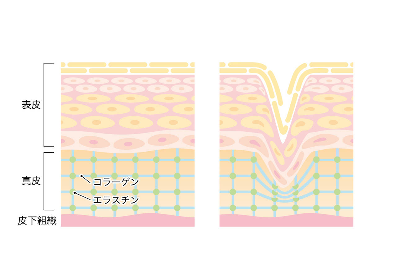 pattern_1