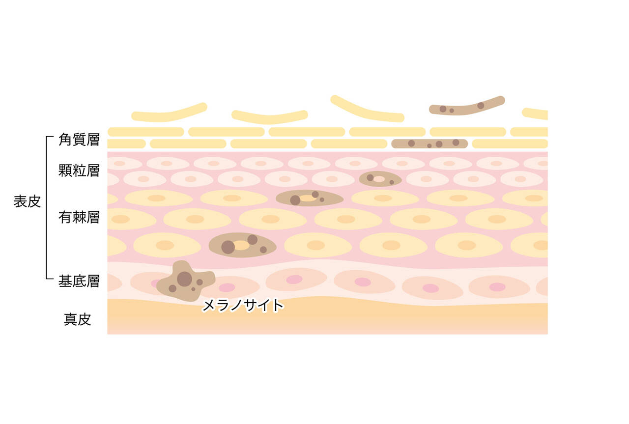 pattern_1