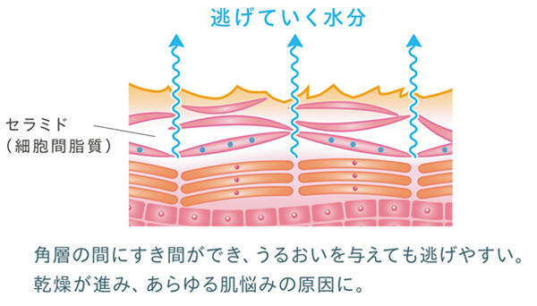 pattern_1