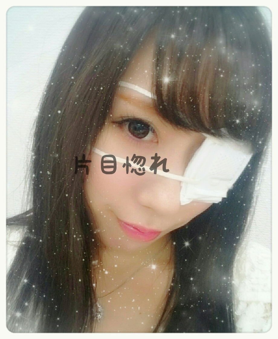 怪我ではありません 笑 With Lab ライフスタイル With Online 講談社公式 恋も仕事もわたしらしく