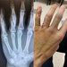 Papa Roach - I’m sorry to report that I broke two fingers... | Facebook