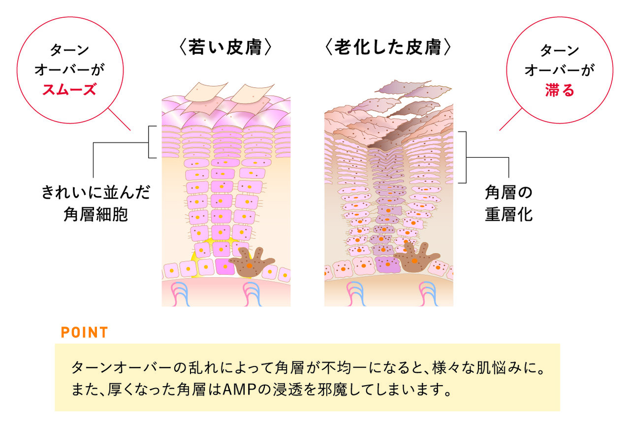 ターンオーバーの乱れ