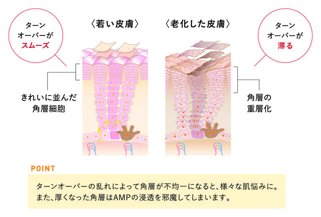 ターンオーバーの乱れ