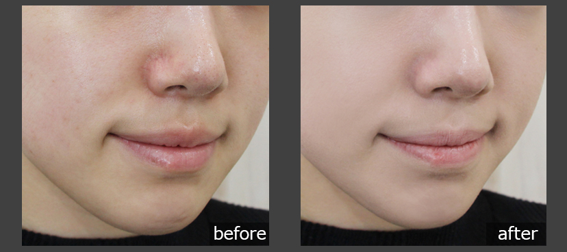 エイプリルスキン マジック スノークッション