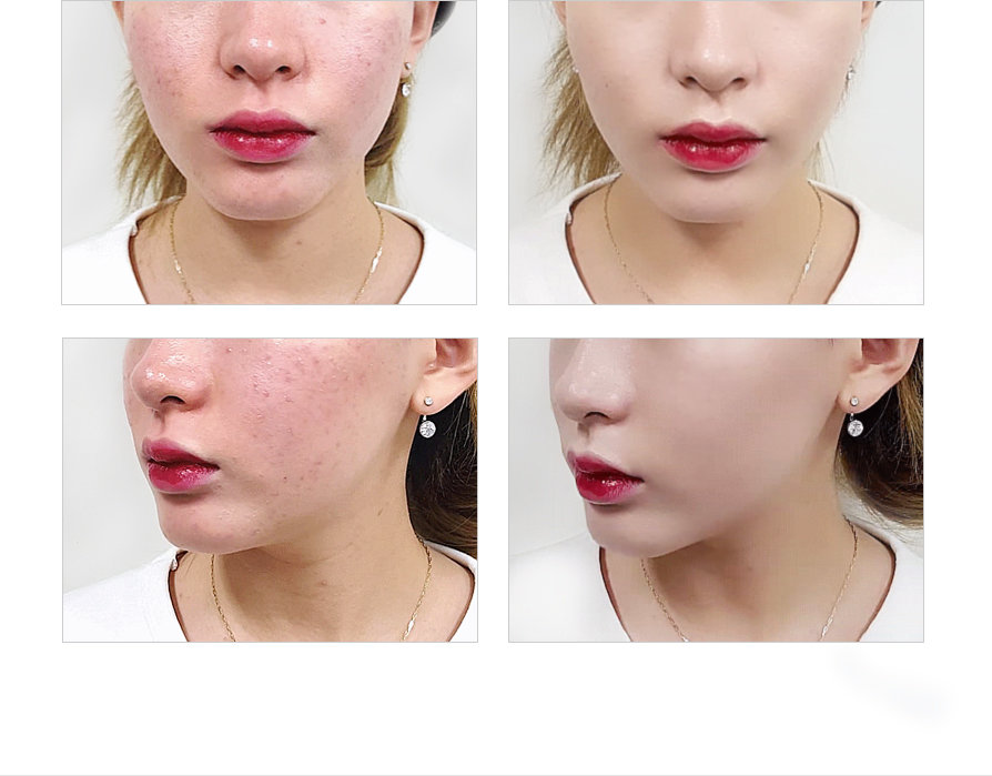 ネイクアップ フェイス　ウォーターキング カバークッション