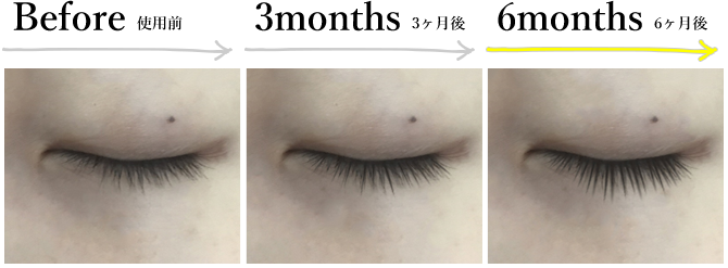 マツエク　ビフォーアフター