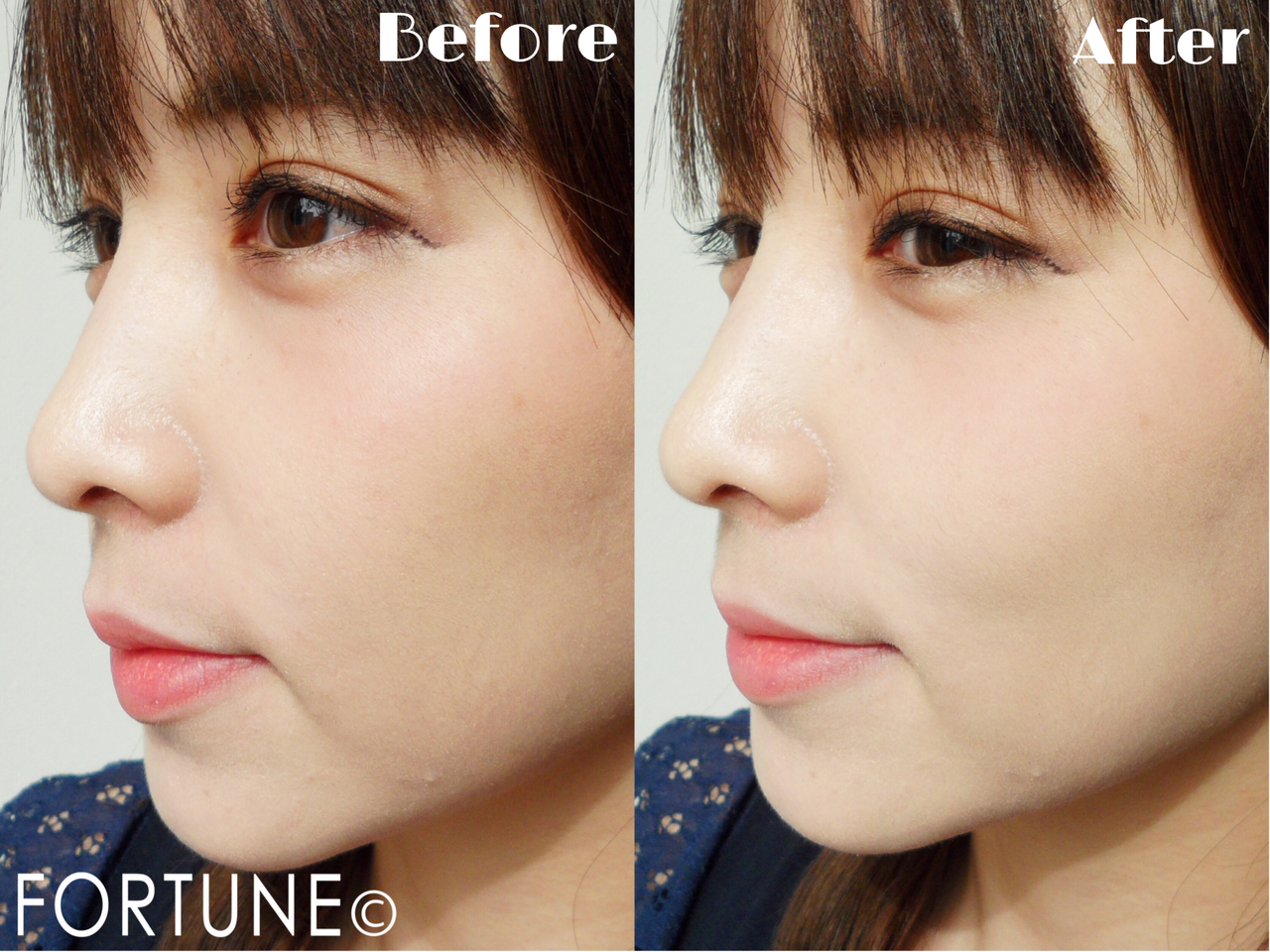 スノービューティー　資生堂