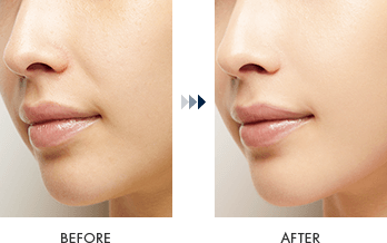 ラスティングベース