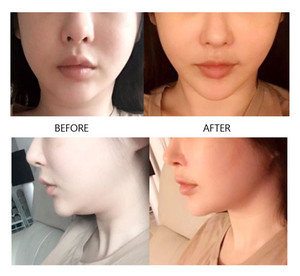 パーフェクトVリフティングマスク　小顔　おすすめ　韓国　ブレイク