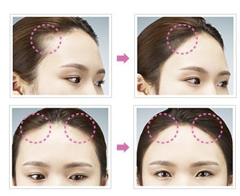 マモンド　パン パン ヘア シャドウ　小顔　効果　韓国　コスメ