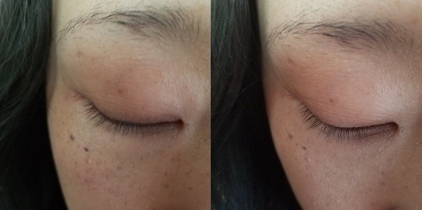 左：CCクリームのみ 右：気になる部分にBBクリーム使用