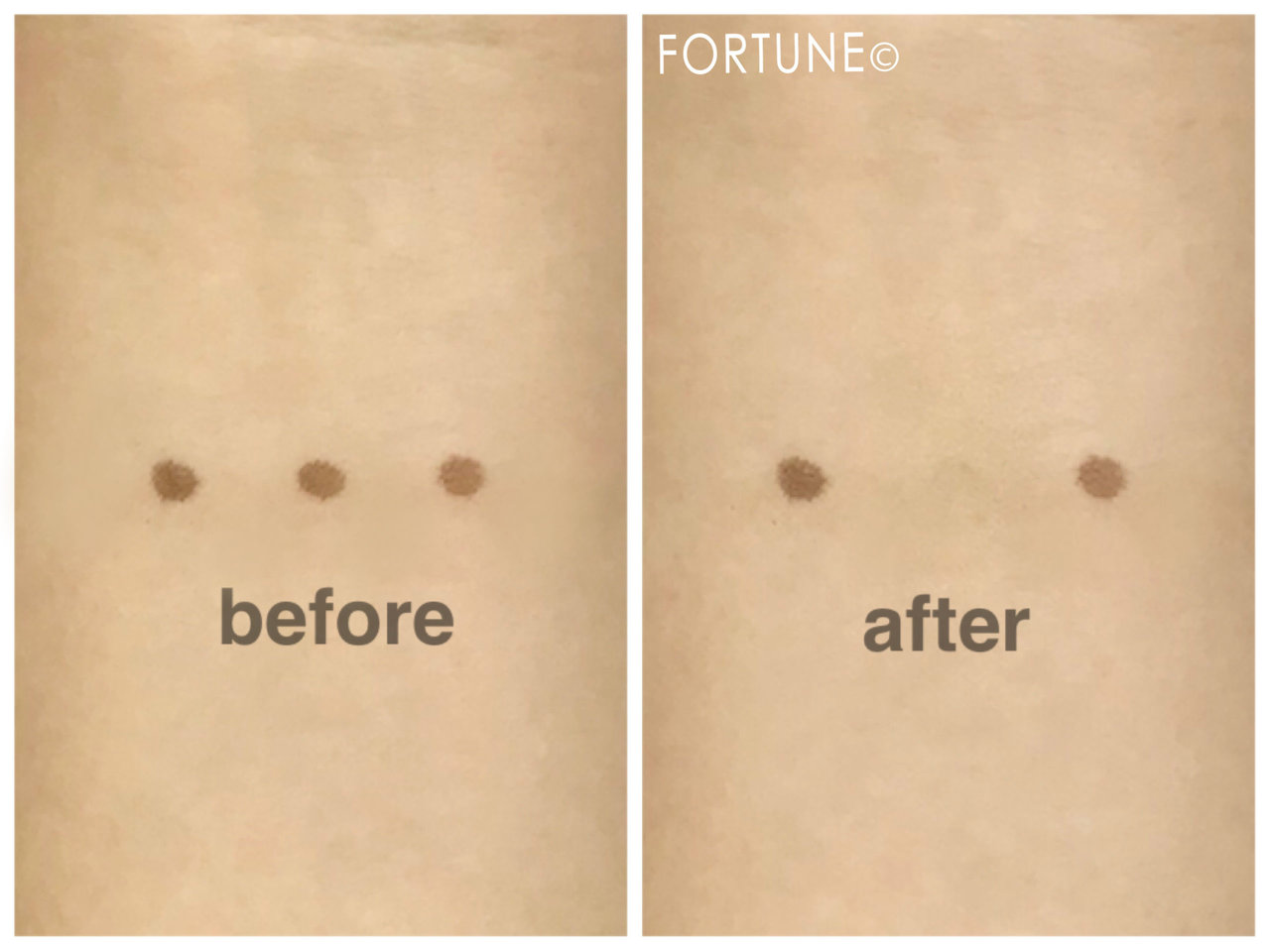 マキアージュ　コンシーラーリキッド EX