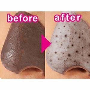 皮脂吸い出し 部分用パック ガスール&レッドパワー