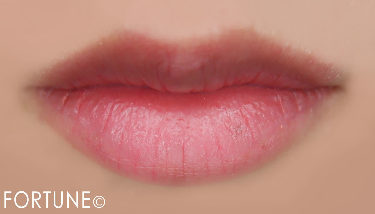 ナリス　薬用バーム「セルカ」　使用前