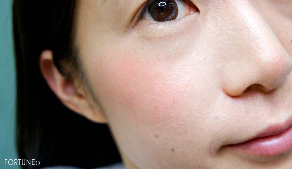 RD559 リュクスコーラル