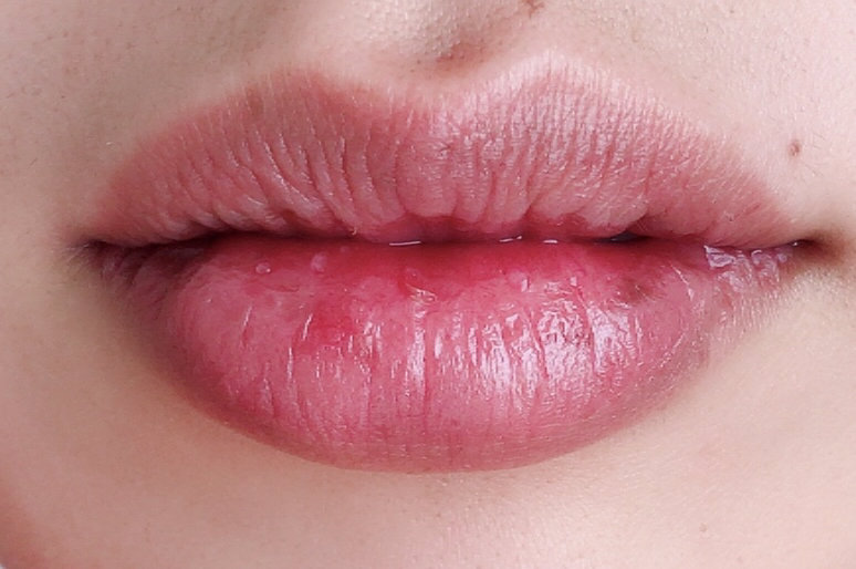 ｄプログラム　リップ　モイスト　エッセンス　医薬部外品　リップクリーム　リップ　リップエッセンス　30代　40代　唇　乾燥　カサカサ　ひび割れ　リップカラー　