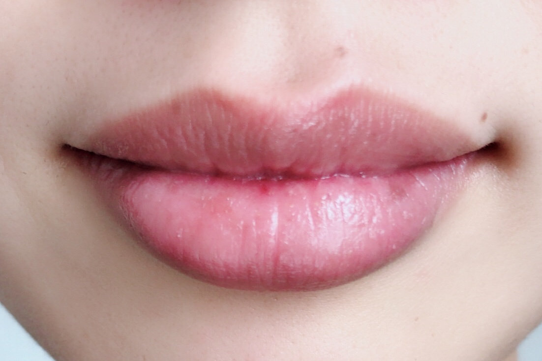 ｄプログラム　リップ　モイスト　エッセンス　医薬部外品　リップクリーム　リップ　リップエッセンス　30代　40代　唇　乾燥　カサカサ　ひび割れ　リップカラー　