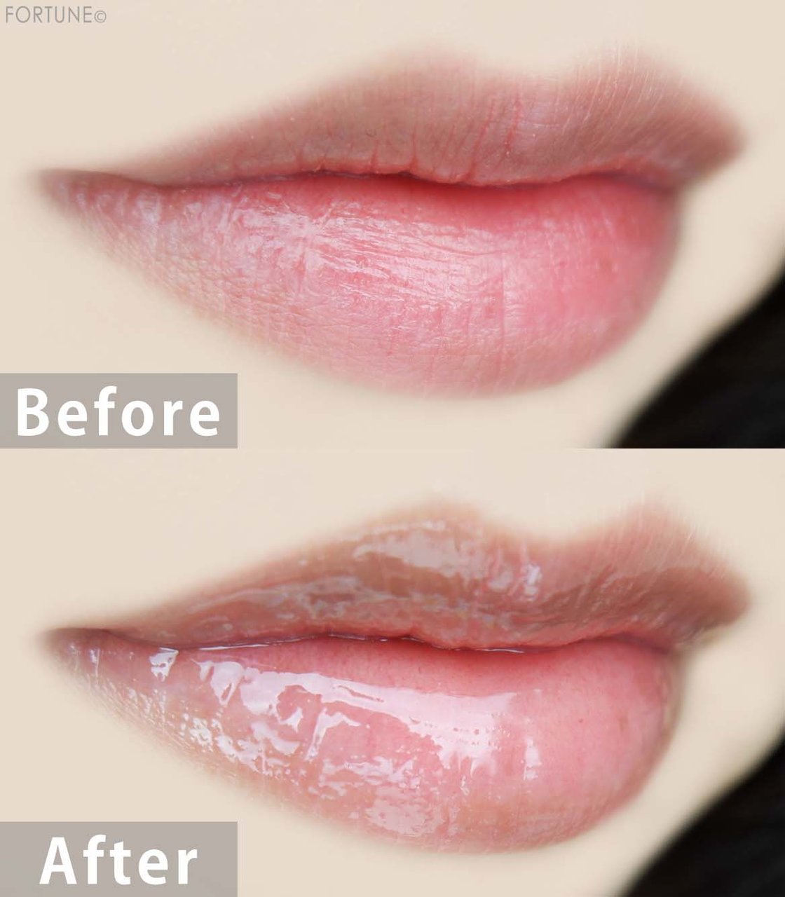 アレスクラ　「リッププランパー ヒミツコレクション」