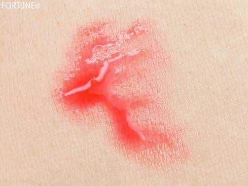 SUGAO（スガオ）「ジュレ感シアーリップティント」コーラルレッド